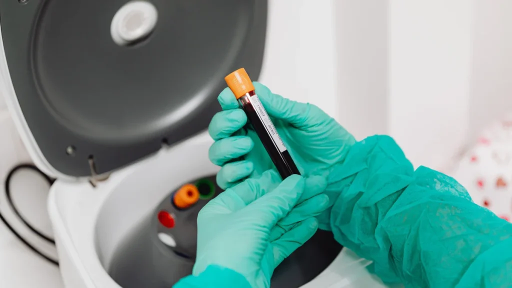 Hematología Biodiagnossis (4)