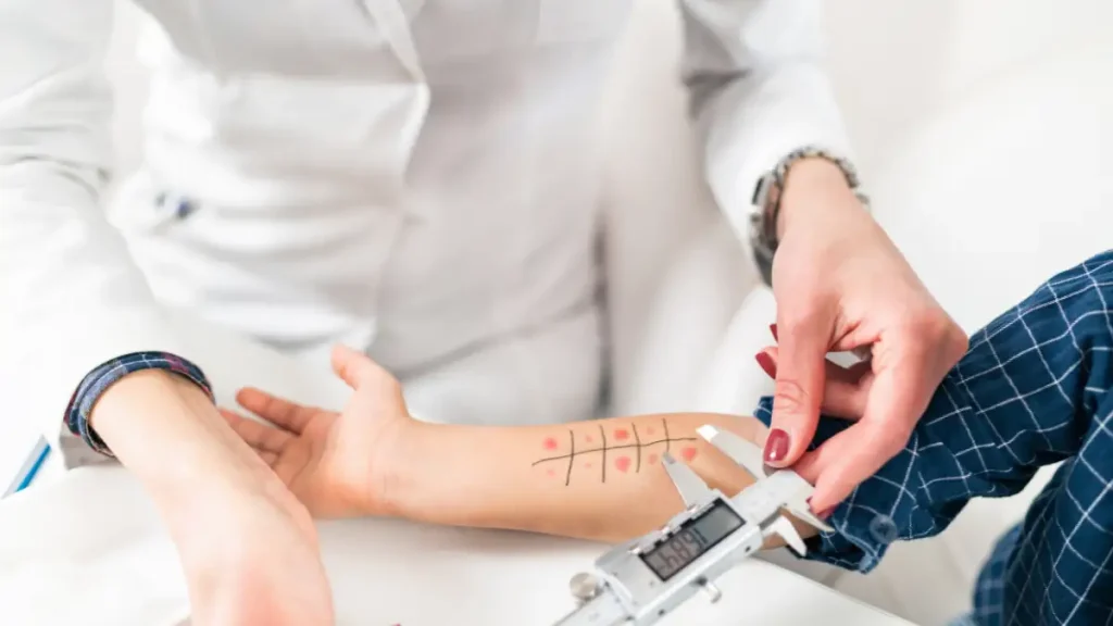 Inmunoserología e Inmunología Biodiagnossis (5)