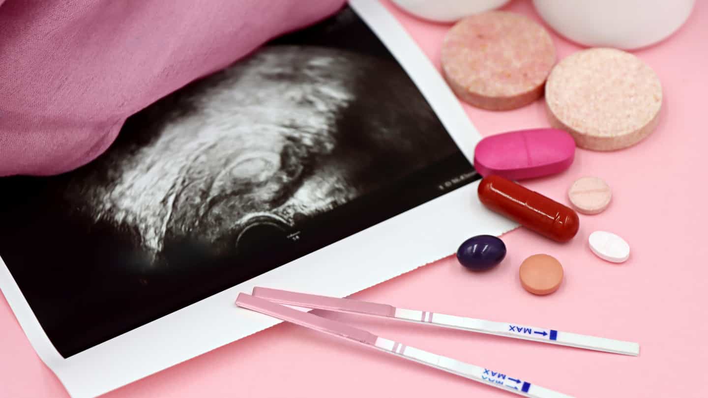 Biodiagnossis Examenes hormonales (2)