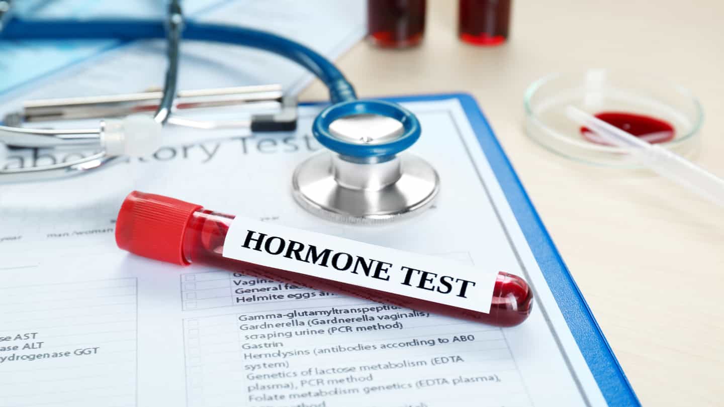 Biodiagnossis Examenes hormonales (3)